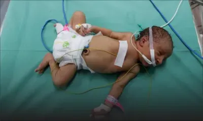 Trente-neuf bébés en danger de mort à l'hôpital de Gaza en raison du manque d'oxygène 