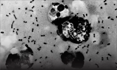 La Chine prend des mesures après un cas de peste bubonique