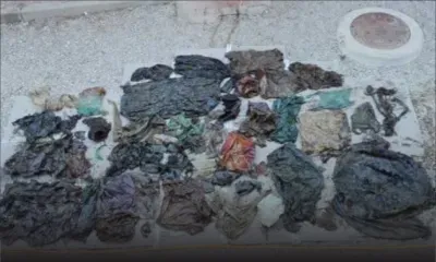 Espagne : un cachalot échoué avait avalé 29 kg de déchets plastiques