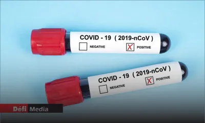 Covid-19 : 54 nouveaux cas positifs ; 53 admissions