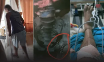 Histoire vécue : victime d’un accident de la route, son avenir est incertain