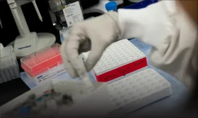 Covid: l'épidémie s'accélère, pic pas encore atteint, selon l'OMS