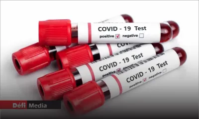 Covid-19 : une augmentation des cas attendue en janvier
