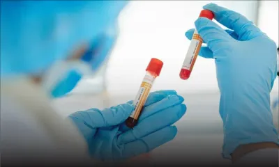 Covid-19 : A Maurice, un patient guéri testé à nouveau positif 