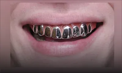 Dents en platine des trafiquants de drogue : l'Icac lance l'opération «rass ledan» 