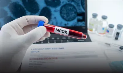 Mpox : 8 personnes actuellement en isolation