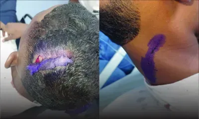 Food and Fun Day : un élève agressé à coups de sabre dans une chambre d’horreur à l’école