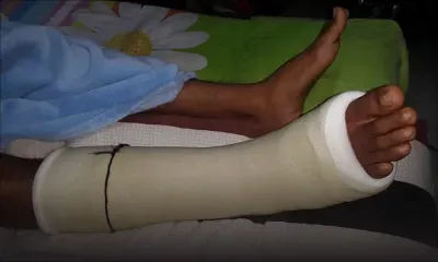 Caudan : un étudiant blessé et alité après un saut de 12 mètres