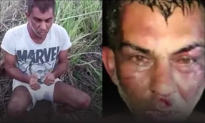 Il raconte son enlèvement et son agression : «Nou pu bizin sott to deux poignets ek to sexe», lancent ses ravisseurs