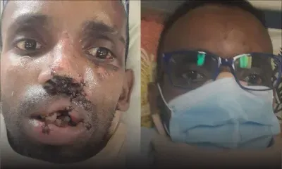 Réclamation de dommages après un accident : Gérard Ludovic Désiré Saminaden défiguré et alité