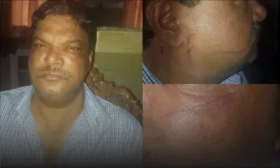 «Je n’ai jamais été battu par ma femme», affirme Mahen Gowressoo après les photos de lui postées sur Facebook 