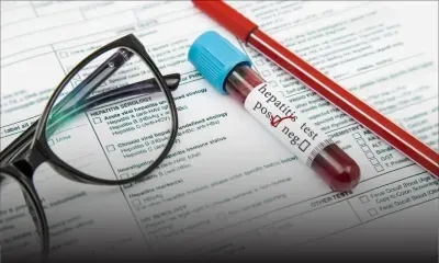 Hépatite d'origine inconnue : l'OMS a recensé 348 cas