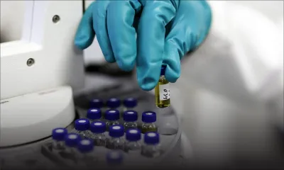  Alzheimer: les experts encouragés par les résultats positifs d'un nouveau médicament