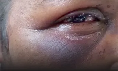 Devi, 56 ans, violemment agressée par un voleur 