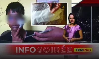 Agressé au cutter par un camarade : 20 points de suture au visage pour un collégien