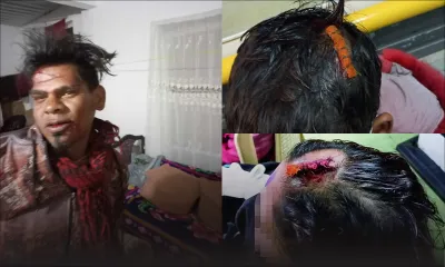 Ivre, leur père les agresse au sabre : «Koma dir mo nam pe sorti», confie son fils de 12 ans