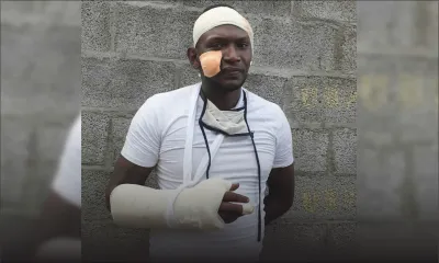 Règlement de comptes sanglant - Jean Kevin, la victime : «Zot pase  la scie lor mo tendon»