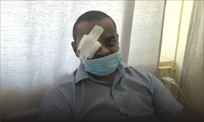 Il risque de perdre l’usage d’un oeil - le policier Jimmy Baptiste : «San mark mwa a vi, mais mo pou surmonte»