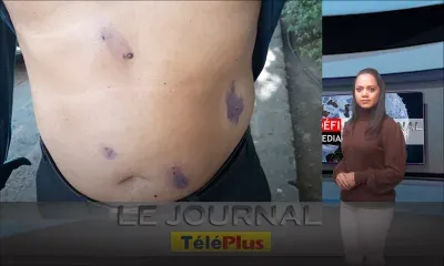 Le JT – Il se bat pour sa vie, Hasmat Jameer a sauvé celle de son père en risquant la sienne