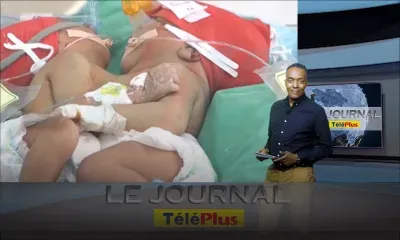 Le JT - Marie Cléa et Marie Cléane : les sœurs siamoises baptisées ce mardi