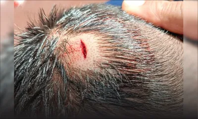 Jules Kœnig Government School - bullying : le parent d’un élève demande au ministère d’agir 