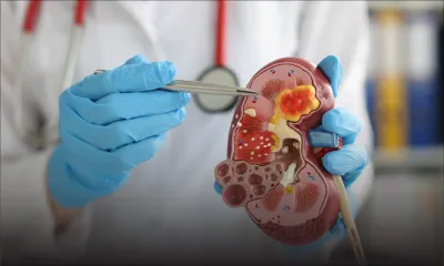 Santé : lancement d’une base de données rénales 