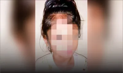 Elle souffre de paralysie cérébrale : l’enfance volée de Chimera, 6 ans