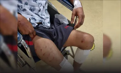 Attaqué par des chiens lors d’une site visit - Divesh, 25 ans : «Monn pas dan lamor»