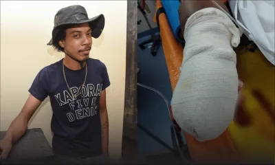 Lino Louis a une jambe sectionnée lors d’un accident de la route