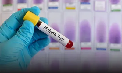 Nord : un cas importé de malaria détecté