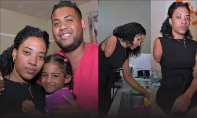 Amputée du bras droit après un accident de la route en 2014 - Marie Aurélie Sarajane Brune : «C’est un combat au quotidien» 