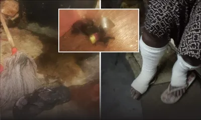Attaque au cocktail Molotov à Sainte-Croix : une dame de 70 ans et son fils blessés