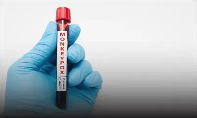 L'Inde rapporte son premier cas de variole du singe