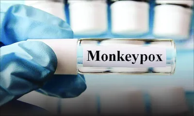 Variole du singe à la Réunion : Maurice sur un pied d’alerte 