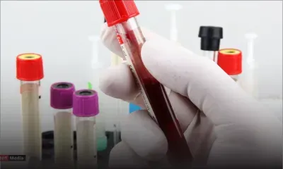  Un cas suspect de Mpox : Une femme de 20 ans en isolement 