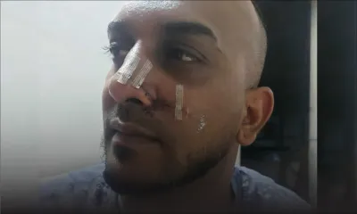 Rixe sanglante à Vallée-des-Prêtres : un père de famille menacé et tabassé dans sa voiture