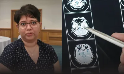 Intervention chirurgicale rare en INDE : Nashila Bibi Sakhabuth surmonte sept anévrismes sacculaires au cerveau
