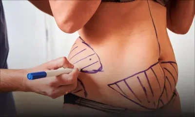 Chirurgie plastique : faire la différence entre complication et erreur médicale