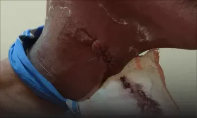 Déploiement de la SMF et de la CERT - prison de Melrose : entre intervention musclée et accusations de brutalités 