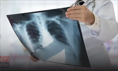 Covid-19 : un technicien en radiologie fait part de ses craintes 