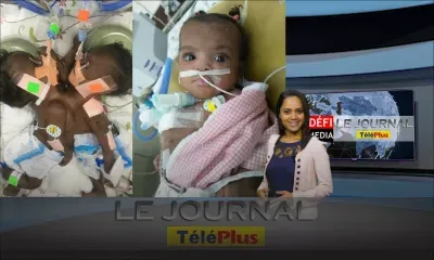 JT - Marie-Cléanne Papillon, troisième bébé miracle au monde de la chirurgie de séparation des jumeaux