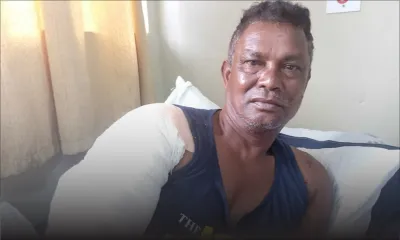 Sanjay Bissoo, rescapé admis à la Burns Unit : «J’ai ressenti une forte brûlure et je me suis évanoui» 