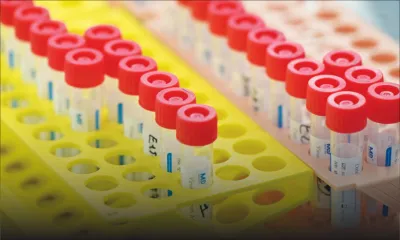 Séquençage : par manque de moyens, Maurice est loin du compte