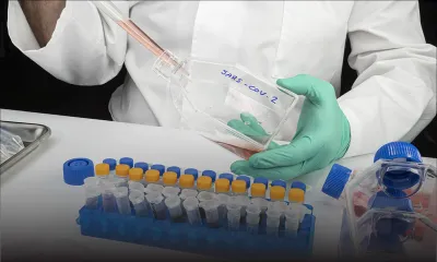 Covid-19 : des professionnels de santé plaident pour plus de séquençages à Maurice