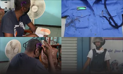 Lors d’une bagarre : son poignet est sectionné le premier jour de l’an