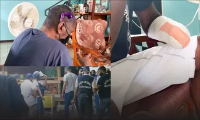 L’homme qui a eu un poignet sectionné se confie 