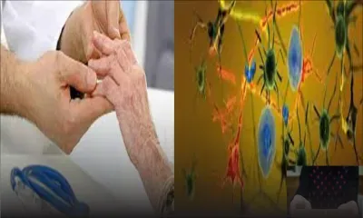 Parkinson: comment faire face à maladie ?