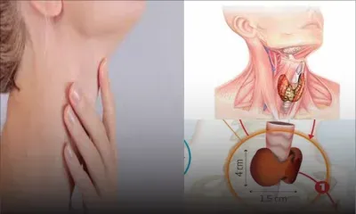 Thyroïde : Quels examens faire pour dépister et diagnostiquer ?