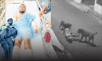 Attaqué par deux Rottweilers en pleine rue au quartier Ward 4 dimanche soir - la victime : «J’ai cru que les chiens allaient me dévorer»