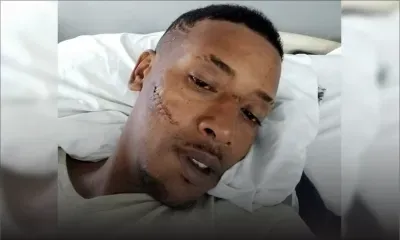 Agression sanglante dans le métro : Steward Pierre, 35 ans, dit avoir vu la mort de près